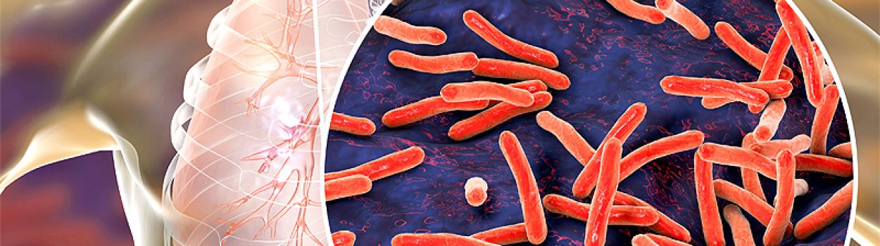 Tuberculosis-infection